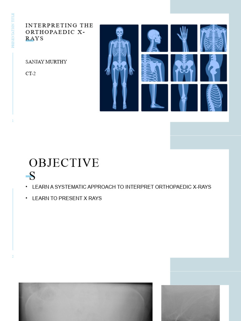 Interpreting The Orthopaedic XRays New PDF Anatomical Terms Of