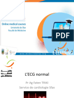 Ecg Normal