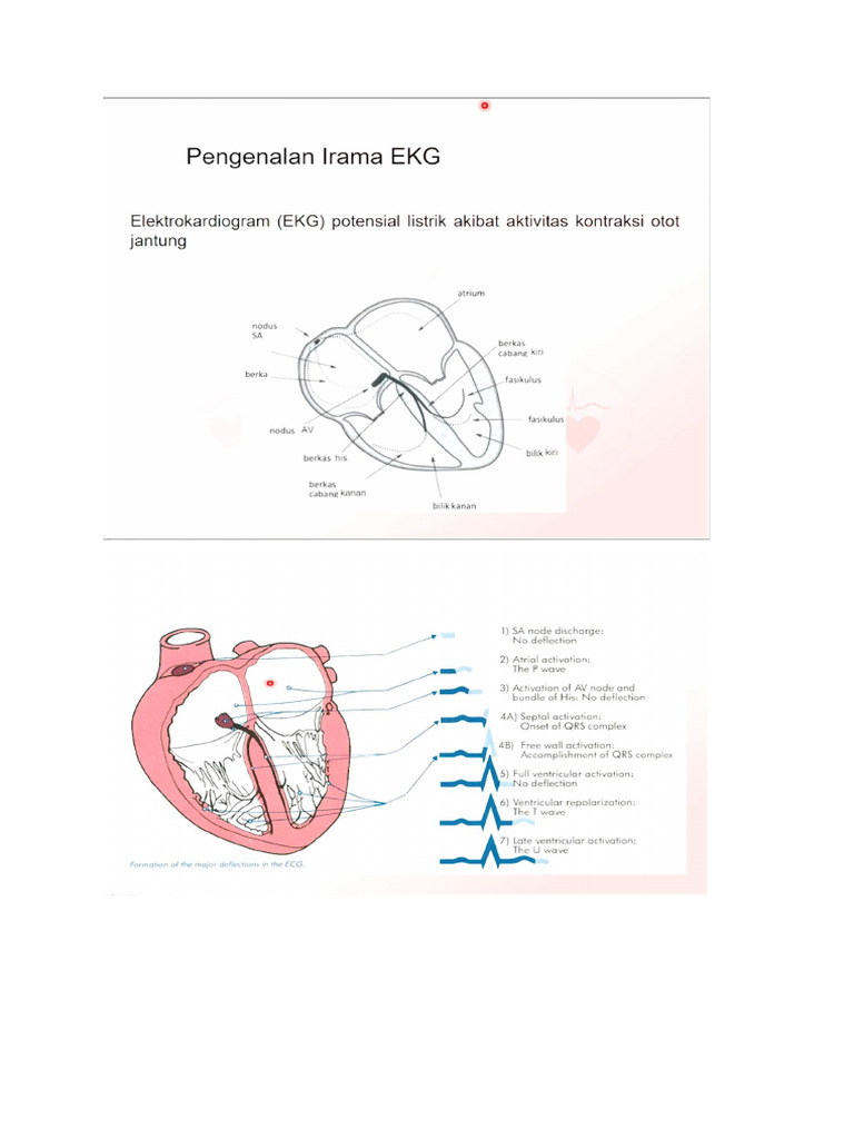 Membaca EKG Asistol dan PEA | PDF | Memasak, Makanan, & Anggur