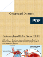 Dysphagia