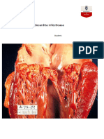 Endocardita Infectioasa