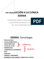 Edema