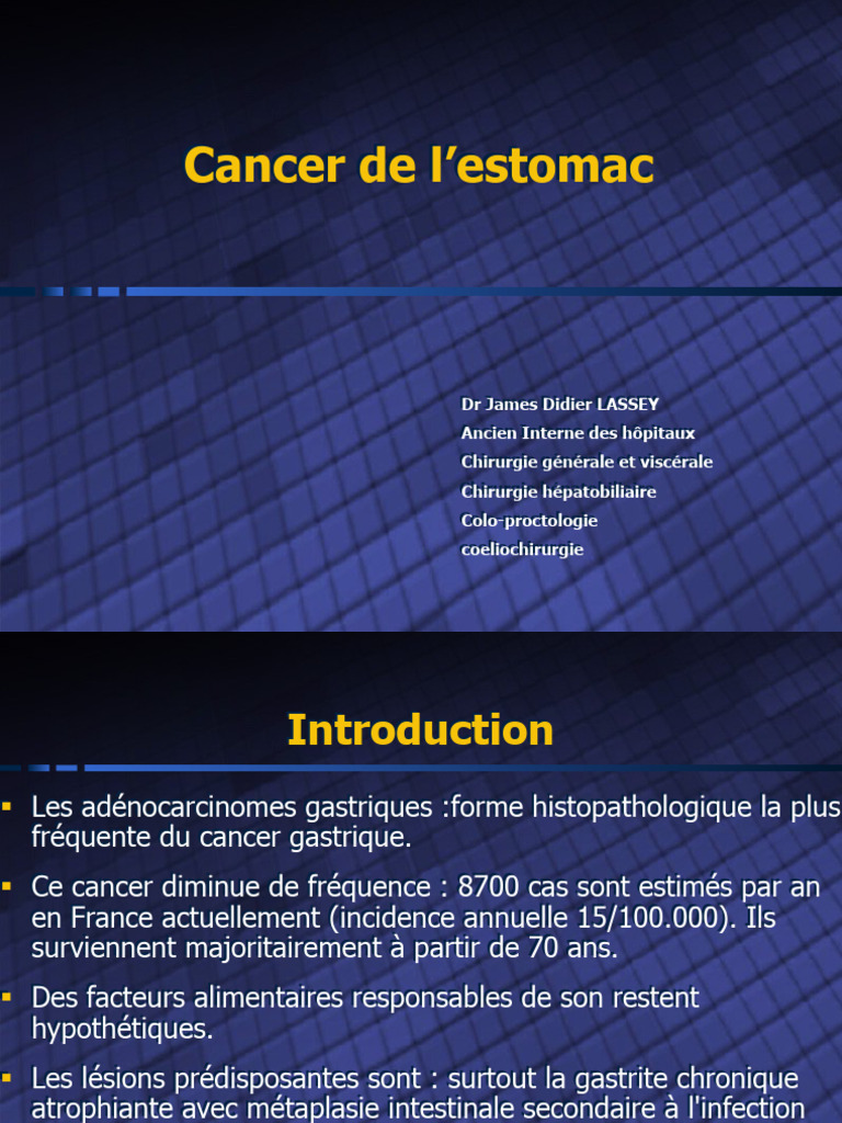 Comprendre le cancer de l'estomac PDF Cancer Gastroentérologie — free download