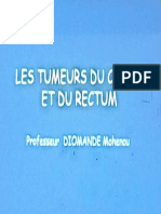 LES TUMEURS DU CÔLON ET DU RECTUM++++