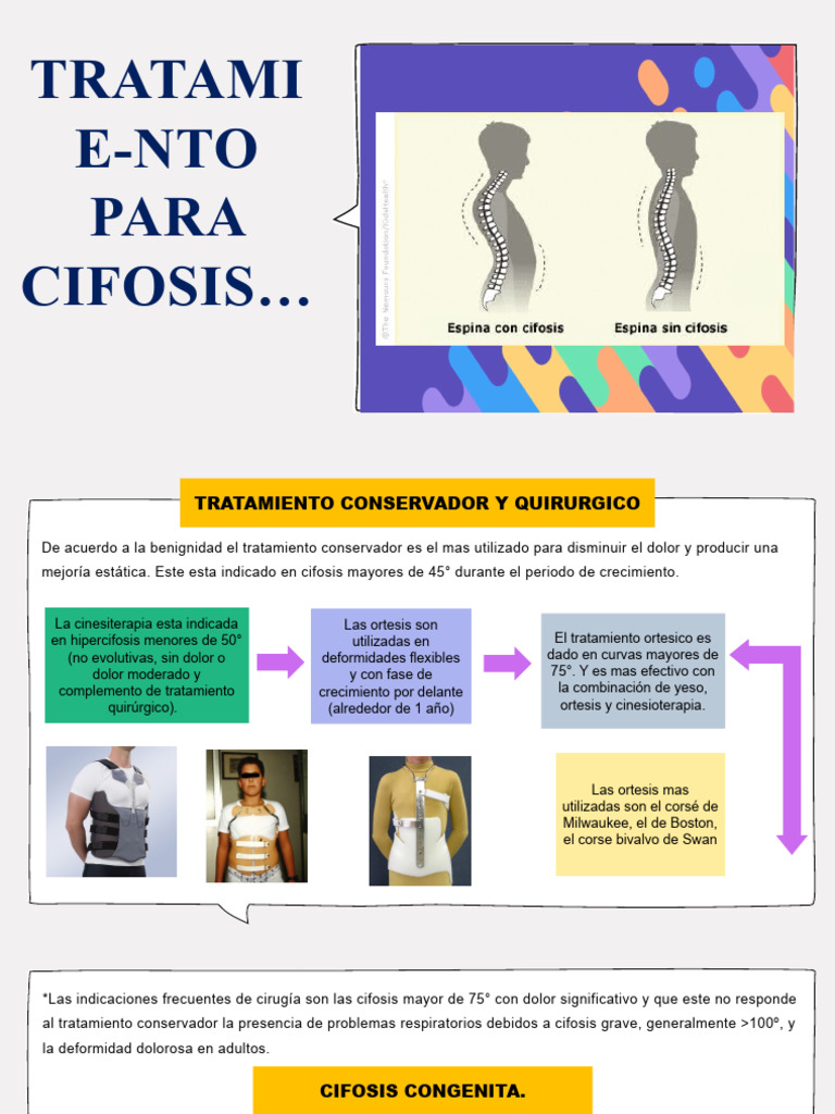 Tratamiento Para Cifosis PDF