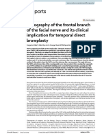 Topography of The Frontal Branch of The Facial Nerve and Its Clinical Implication For Temporal Direct Browplasty