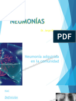 5 MI Neumonías