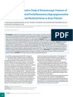 A Comparative Study of Dermatoscopic Features of Acne-Related Postinfl Ammatory Hyperpigmentation in Facial and Nonfacial Areas in Asian Patients
