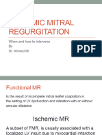 Ischemic Mitral Regurgitation