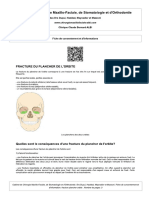 Fiche_Consentement_Fracture_Plancher_Orbite