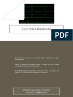 Electrocardiograma