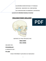 Fracture Maxillaire