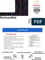 Pericarditis