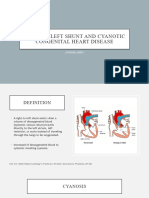 Right to left shunt and Cyanotic Congenital Heart Disease