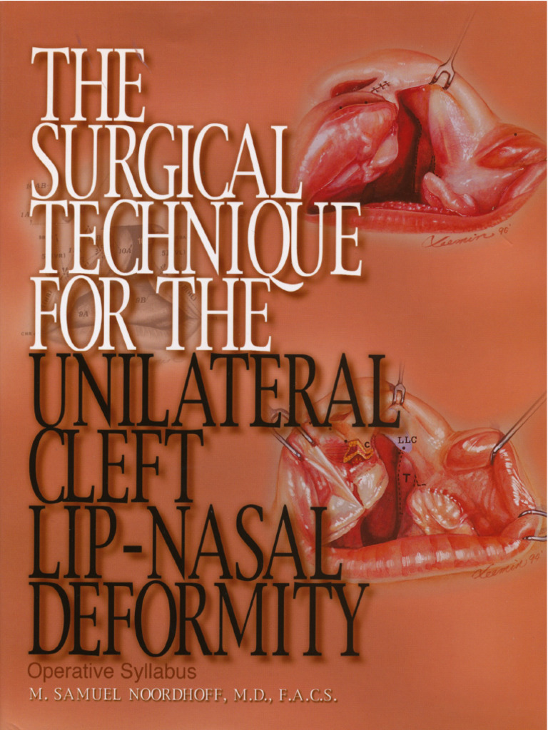CLEFT LIP SURGERY TRAINING intelligence overview