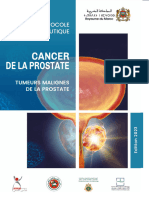 PT Cancer de La Prostate