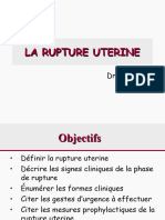 La Rupture Uterine