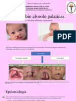 Fisura Alveolo - Palatina