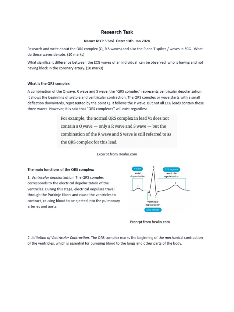 Urgent Understanding The Implications Of An Inverted Qrs Complex - xycm3me