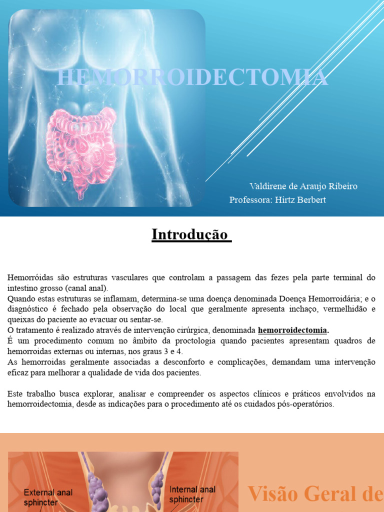 HEMORROIDECTOMIA | PDF