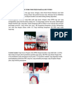 Connectors For Fixed Partial Dentures