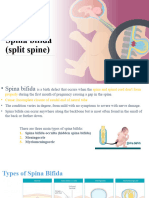 Spina Bifida (Split Spine)