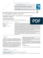 Successful Reconstruction Using Three Flaps Combina 2024 International Journ