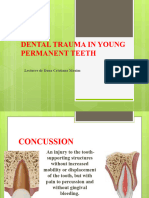 Dental Trauma in Young Perma123nent Teeth