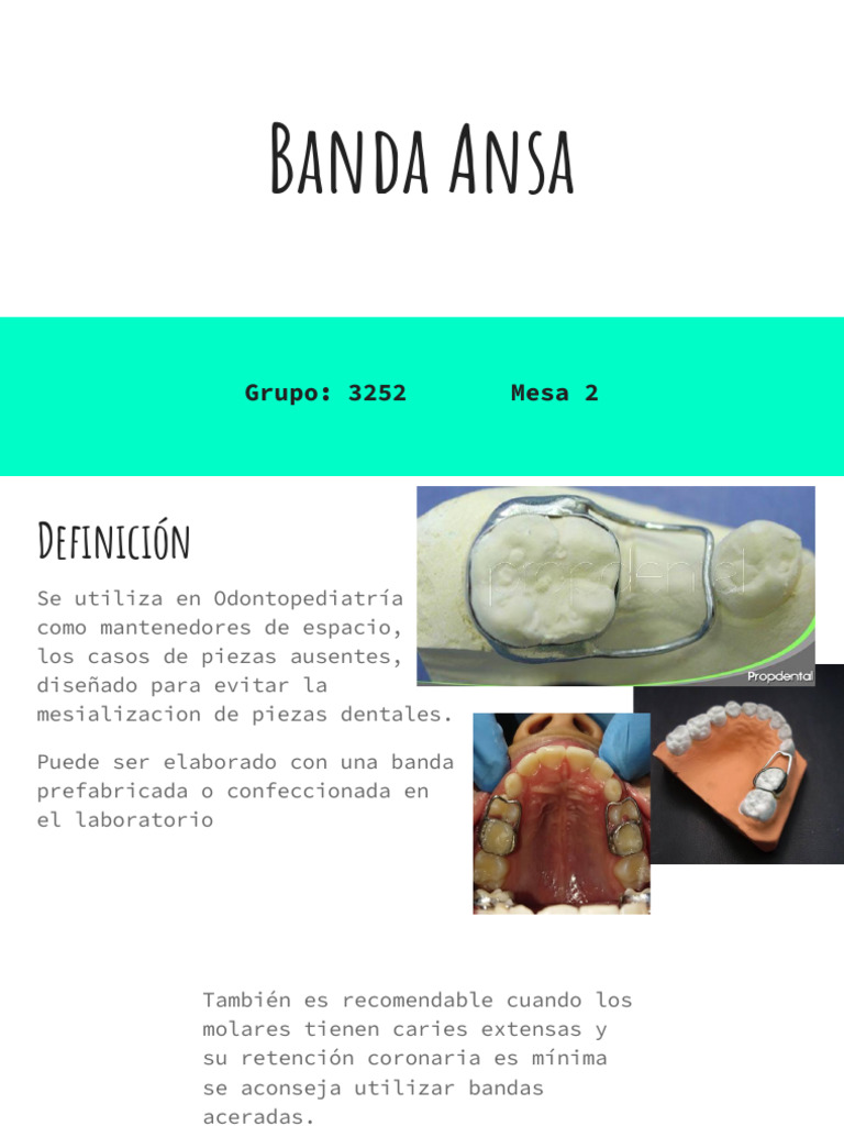 Banda Ansa en Odontopediatría | PDF | Ramas de Odontología ...
