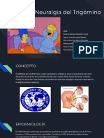 Neuralgia Del Trigémino