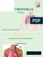 Neumotorax