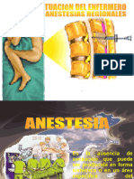 Actuacion Enfermeria Anestesia Regional
