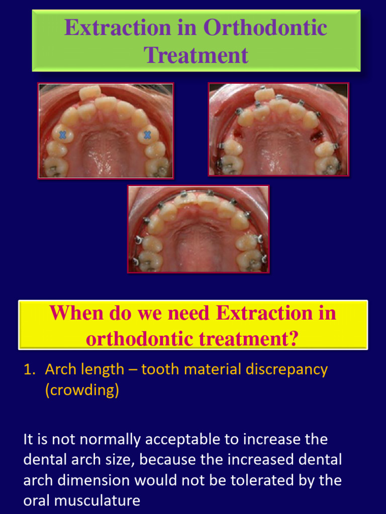 Guidelines for Orthodontic Extractions | PDF | Orthodontics | Tooth