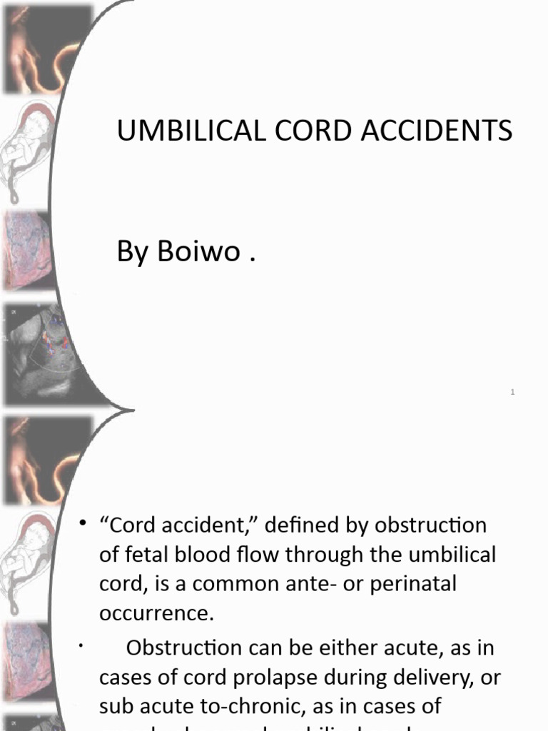 Umbilical Cord Accidents1 PDF Fetus Prenatal Development