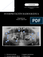 Interpretacion Radiografica