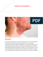Dermatita Seboreică