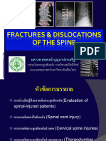 Fractures & Dislocations of The Spine (Medical Student V)