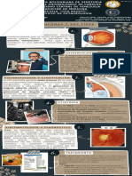 Glaucoma y Sus Tipos (Infografía)