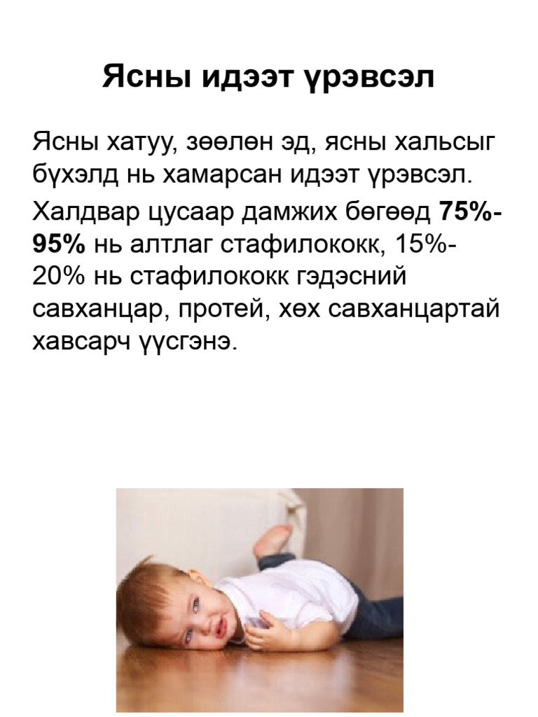 Ясны Идээт Үрэвсэл | PDF