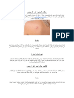 علاج الجدرة في الرياض