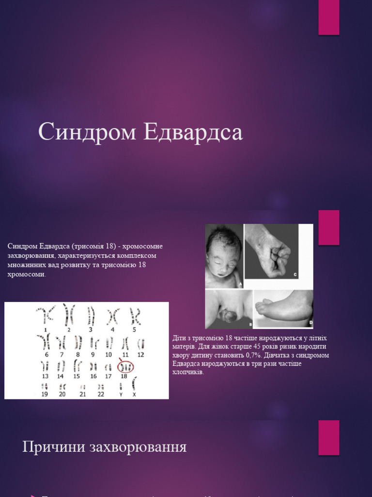Синдром Едвардса | PDF