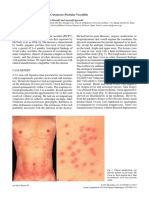 Pustular Vasculitis