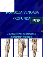 TrombozaProfunda 2