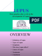 Lupus Presentation