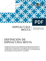 2 - Hipoacusia mixta