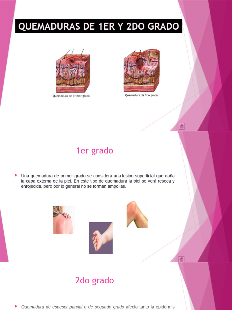 quemaduras-de-1er-y-2do-grado-pdf-quemar-herida