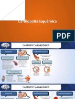 Cardipatía Isquémica