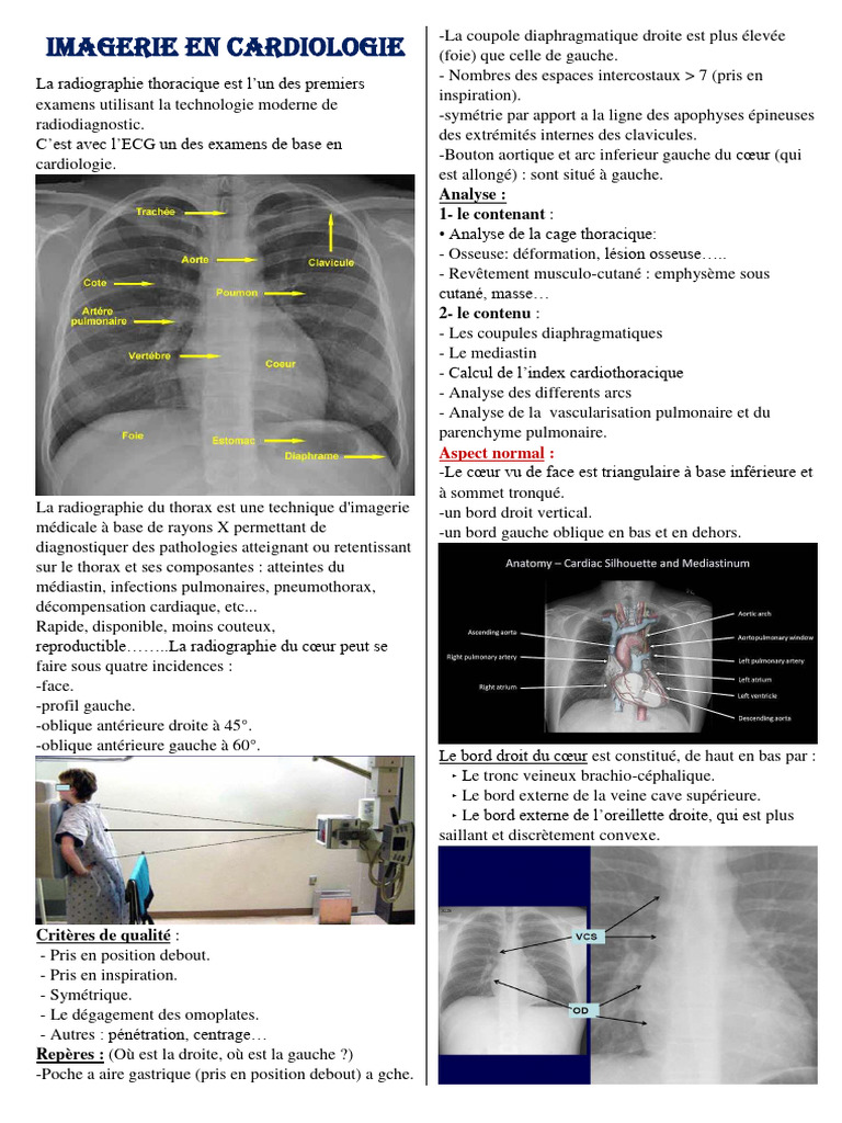 Analyse de l'index cardio-thoracique | PDF | Échocardiographie | Cœur