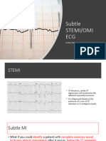 4-Subtle ECG in ACS