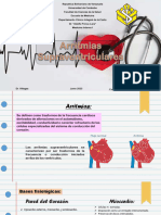 Arritmias Supraventriculares